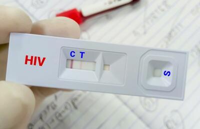  به پویش  «من هم آزمایش HIV می‌دهم» بپیوندید 