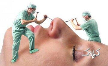  چرا شیادها در بازار جراحی زیبایی کاسبی شان پررونق است؟ - مجله اینترنتی کولاک