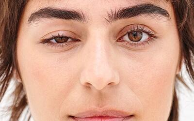  آیا تزریق بوتاکس باعث افتادگی پلک می‌شود؟ افسانه‌ها و واقعیت‌های رایج در مورد بوتاکس و فیلر