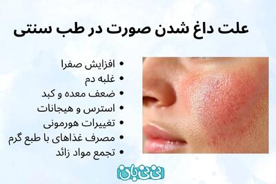  علت داغ شدن صورت در طب سنتی _ ۷ علت + روش‌ های درمانی