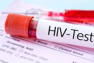  وزارت بهداشت: ۱۱ میلیون نفر در دنیا  مبتلا به HIV هستند/ اگر بتوانیم میزان بیماریابی در ایران را به ۸۰ درصد برسانیم، خیال ما در ارتباط با این بیماری راحت شده