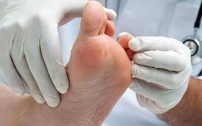  پژوهشگران دلیل بهبود نیافتن زخم‌ها را در ژن این موها پیدا کردند