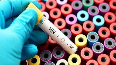  ادامه پویش «من هم تست HIV می‌دهم» در کشور تا ۲۰ آذرماه