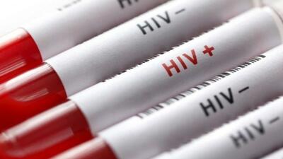  ۹۴ درصد بیماران HIV در ایران با درمان منظم دیگر ناقل ویروس نیستند