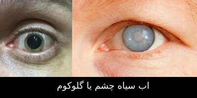  وزارت بهداشت نوار غزه : هزاران نفر با خطر نابینایی قرار دارند