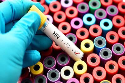  ادامه پویش «من هم تست HIV می‌دهم» در کشور تا ۲۰ آذرماه