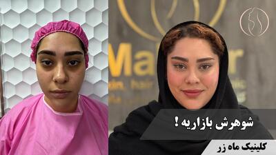 شوهرش بازاریه!  ( کلینیک ماه زر - دکتر میثم ضرغامی )