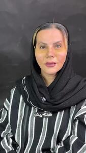  رضایت از عمل بینی بدون بیهوشی در درمانگاه مسیح