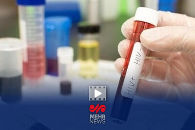  حدود ۴۱ هزار مبتلا به ویروس HIV در کشور