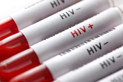  شناسایی 25000 مبتلا به HIV در ایران/ ایدز؛ از راه‌های پیشگیری تا درمان رایگان - تسنیم