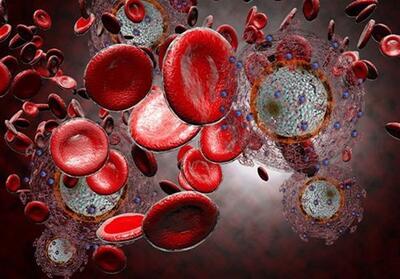  افت توجه جهانی به پیشگیری و درمان HIV؛ زنگ خطر برای سلامت عمومی - تسنیم