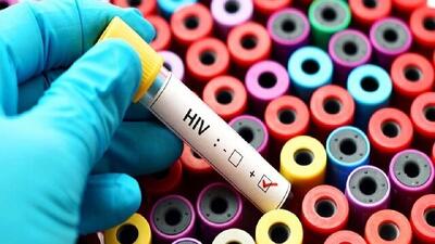  آماری از مبتلایان به ویروس HIV در کشور