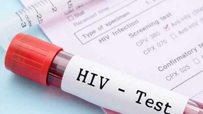  فاش شد بزرگ‌ترین ضعف ایران در کنترل HIV: ۴۰ درصد مبتلایان هنوز شناسایی نشده‌اند / هشدار متخصصان: انگ اجتماعی و تشخیص دیرهنگام، چرخه انتقال ایدز را زنده نگه داشته است | اندیشه قرن