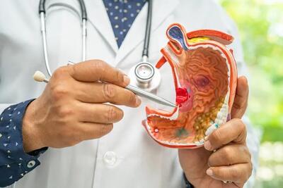  نقش پنهان آلودگی هوا در افزایش خطر بک نوع سرطان
