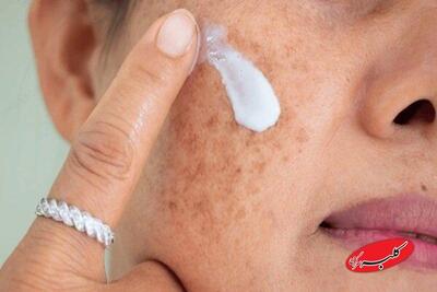  آلودگی هوا و پوست؛ چگونه از التهاب و خطر سرطان پیشگیری کنیم؟ - کلبه سرگرمی