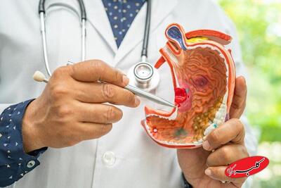  نقش پنهان آلودگی هوا در افزایش خطر بک نوع سرطان - کلبه سرگرمی