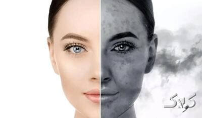  سرطان پوست در کمین شهرهای آلوده؛ هشدار و راهکارهای یک متخصص - مجله اینترنتی کولاک