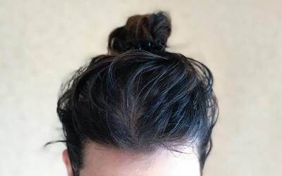  شستشوی موهای چرب و مراقبت اصولی؛ نکات تخصصی