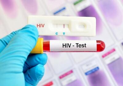  انجام تست رایگان و محرمانه HIV در مناطق تحت پوشش دانشگاه علوم پزشکی مشهد
