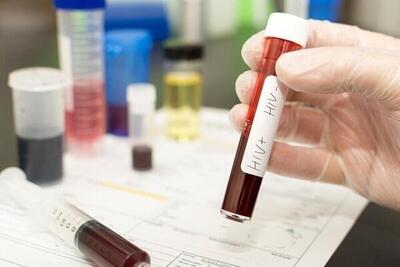  کاهش شیوع HIV در میان معتادان تزریق‌کننده موادمخدر
