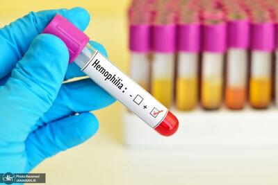  هشدار! پایان ذخایر اضطراری داروهای بیماران هموفیلی