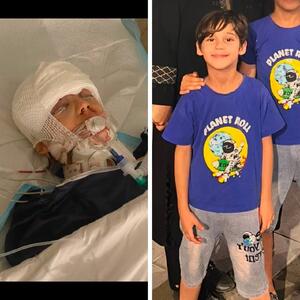  تصویر تکان‌دهنده پسر کوچک سقاب اصفهانی پس از چند عمل مغز هنوز در اغما