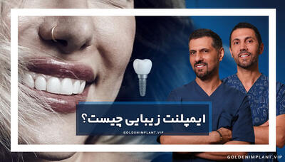  ایمپلنت زیبایی چیست و چه تفاوتی با ایمپلنت معمولی دارد؟