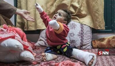  قطع عضو ۶ هزار تن از مردم فلسطین در حملات رژیم صهیونیستی به غزه