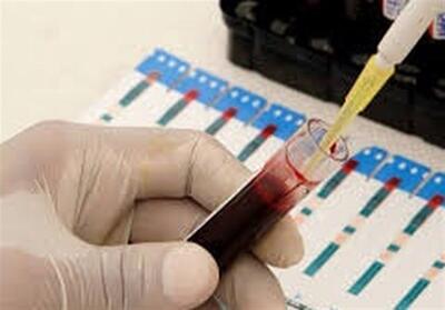  کاهش شیوع HIV در میان معتادان تزریق‌کننده مواد مخدر - تسنیم