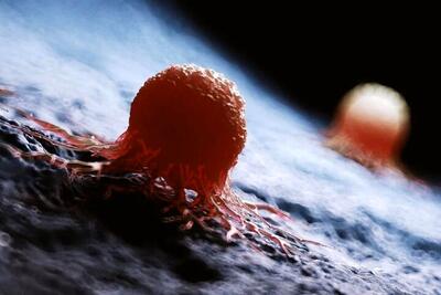  انقلاب در درمان سرطان: هوش مصنوعی راز ۱۰۰ ساله را کشف کرد