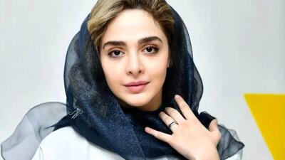  نگاه روز | المیرا دهقانی استایل فرهاد آئیش را کپی کرد! 📸