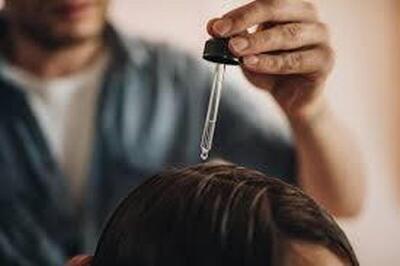  پروکاپیل در مقابل ماینوکسیدیل: کدام برای ریزش مو بهتر است؟