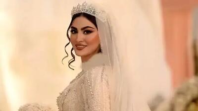  فیلم / مریم مومن برای عروسیش چه کارهای زیبایی رو انجام داد؟ / از تینت لب روسی که حسابی چهره‌شو شاداب کرد تا ....