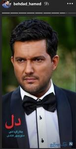  نگاه روز |تغییر چهره ۳۶۰درجه ای حامد بهداد 📸