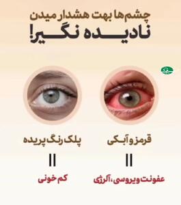  تشخیص بیماری از روی چشم ها+ فیلم