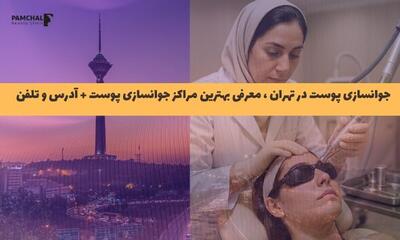  جوانسازی پوست در تهران ، معرفی مراکز مجاز جوانسازی پوست + آدرس و تلفن