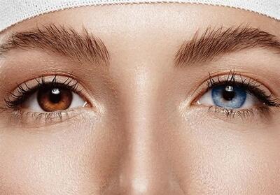 ترغیب مردم به انجام جراحی ممنوعه در خارج از کشور تخلف است - تسنیم