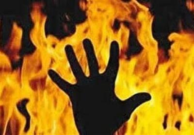 افزایش 475 درصدی فوتی‌ها ناشی از سوختگی در استان بوشهر - تسنیم