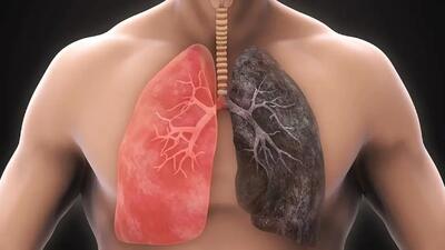  آیا ریه سیگاری‌ها پس از ترک دوباره سالم می‌شود؟