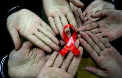  نکاتی که مبتلایان به HIV باید قبل از مراجعه به دندان‌پزشک رعایت کنند