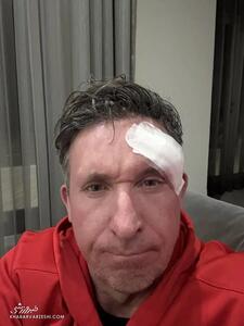 اسطوره لیورپول درگیر سرطان شد