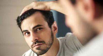  درمان جدید برای طاسی کشف شد