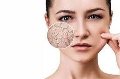  راهنمای کامل سلامت پوست، از روتین روزانه تا مقابله با خشکی و جوش