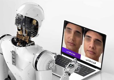  جراحی بینی در تهران با پزشک ۲۴