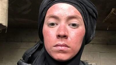 تصاویر شوکه‌کننده از تغییر چهره نیلوفر رجایی‌فر بعد از سریال پایتخت!