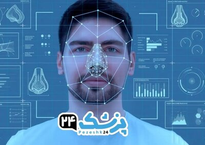  جراحی بینی در تهران با پزشک ۲۴