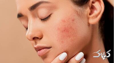 کدام ویتامین‌ها برای پوست ضروری‌اند؟ ؛ راهنمای تغذیه‌ای برای پوستی سالم - مجله اینترنتی کولاک