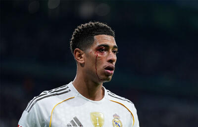 عملکرد ضعیف و چشم خونی جود بلینگام مقابل سلتاویگو / عکس - پارس فوتبال