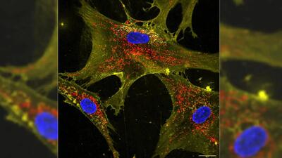 دانشمندان با «ابرشارژ» سلول‌ ها به پیشرفت مهمی در مبارزه با پیری رسیدند