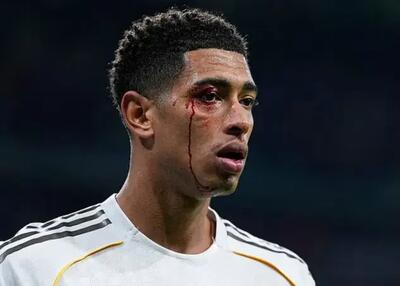 چهره خونین بلینگام در شب مصیبت‌بار (عکس)